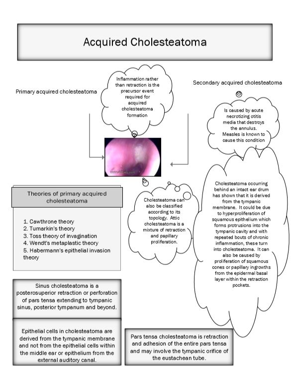 acquired cholesteatoma