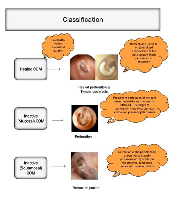 Classification of com