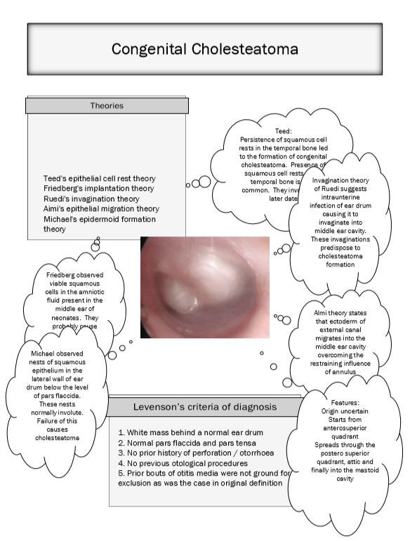 congenital cholesteatoma