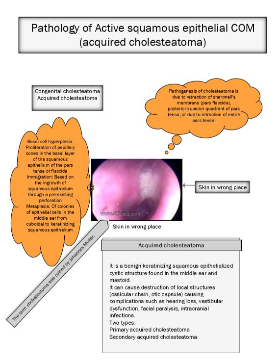 pathology of active squamosal com