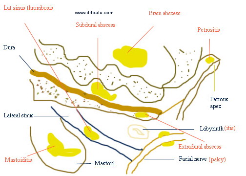 routes of infection spread