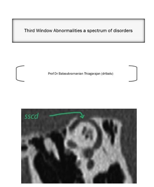 File:Third abn.JPG
