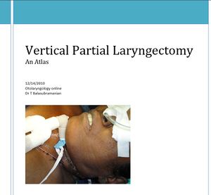 Vplaryngectomy cover.JPG