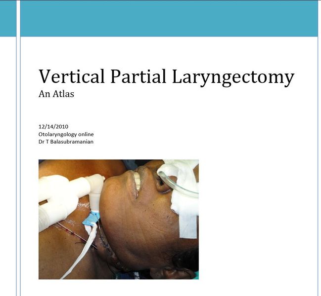 File:Vplaryngectomy cover.JPG