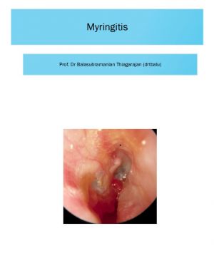 Myringitis cover.JPG