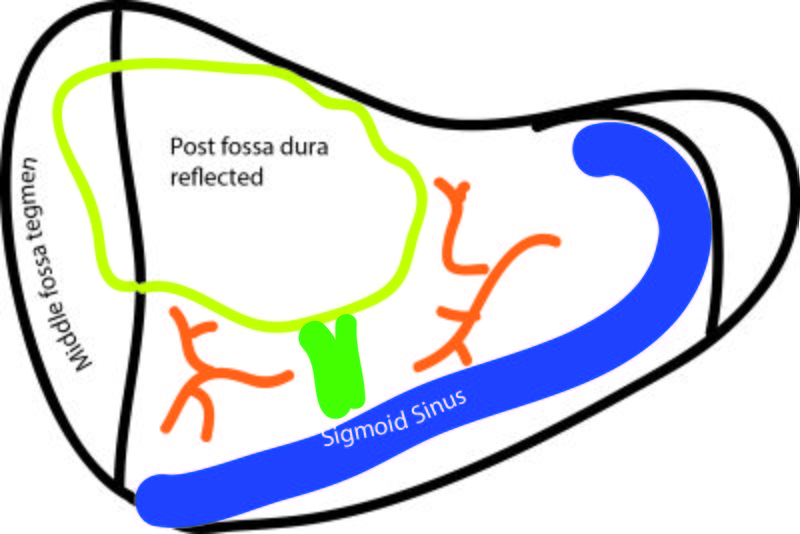 File:Post fossa.jpg