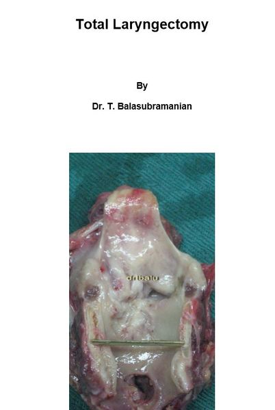 File:Laryngectomy cover.JPG