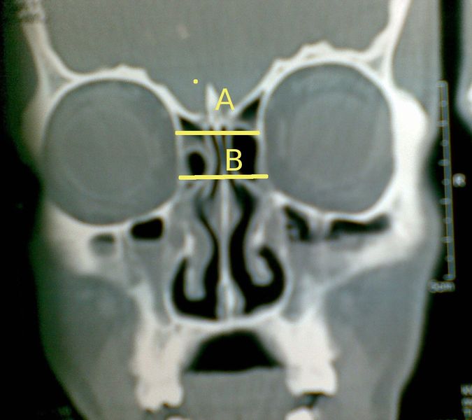 File:Ana 2.jpg