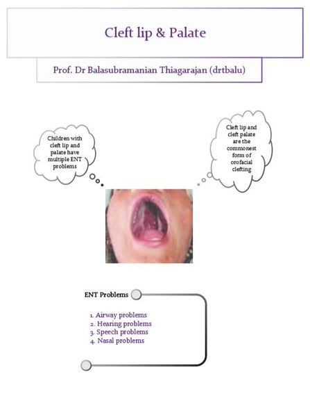 File:Cleftlip palatecover.JPG